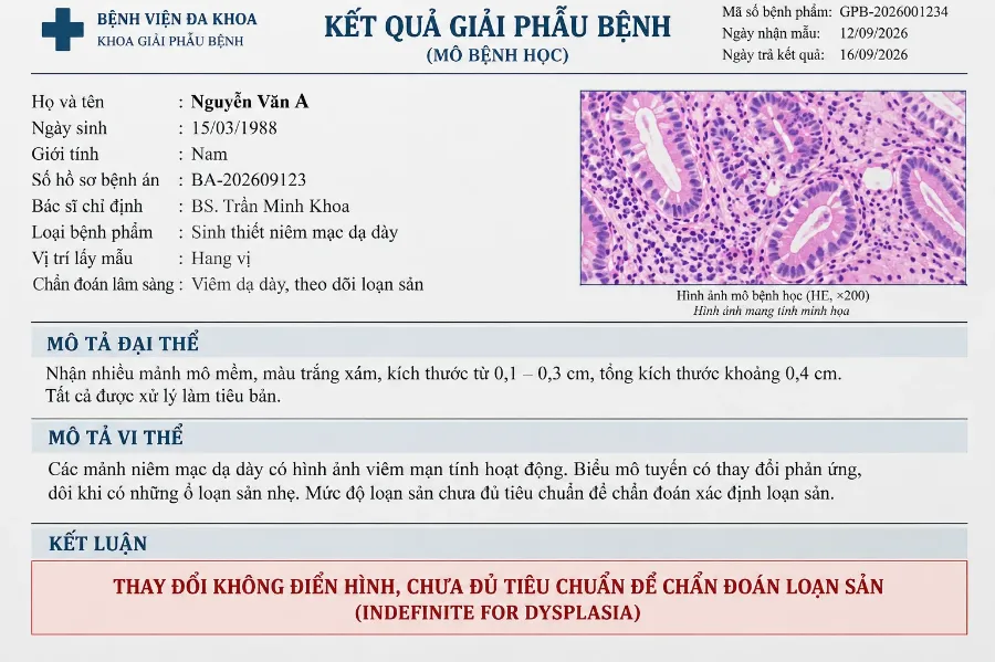 Không xác định được loạn sản