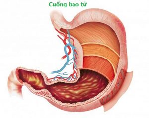 Bệnh đau cuống dạ dày