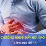 Đầy bụng chướng hơi nên làm gì