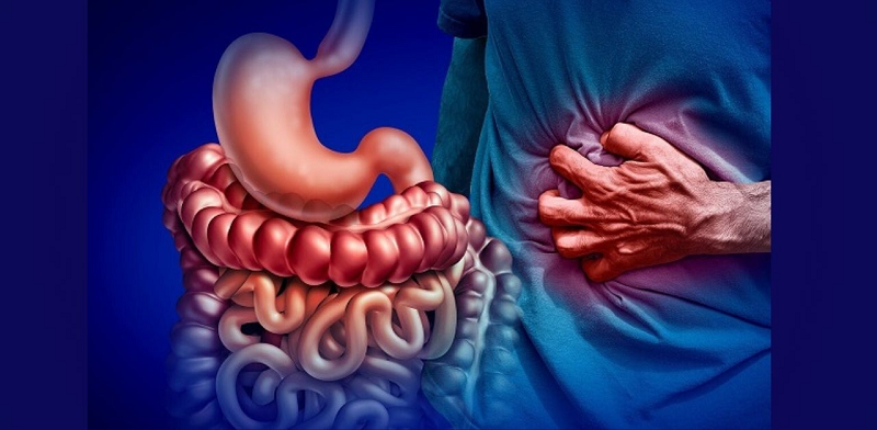 bệnh crohn