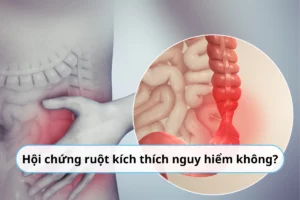 hội chứng ruột kích thích