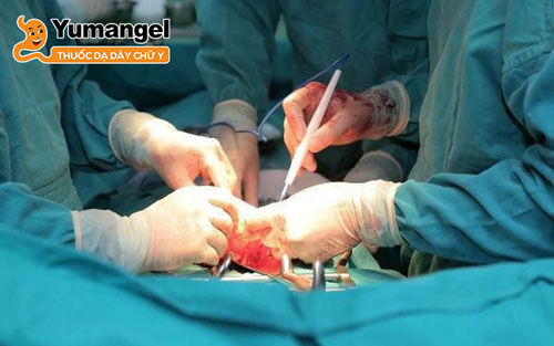Hầu hết người bị thủng thực quản được điều trị bằng phẫu thuật.