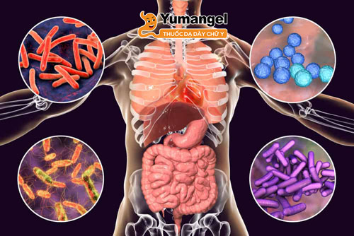 Nguyên nhân gây bệnh lao ruột là do vi khuẩn (hoặc trực khuẩn) Mycobacterium tuberculosis.
