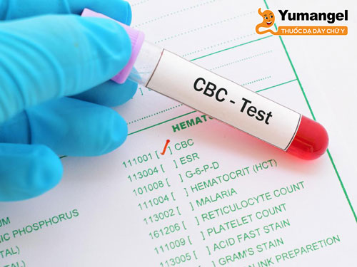 Xét nghiệm công thức máu toàn phần (CBC) chẩn đoán bệnh lao ruột. 