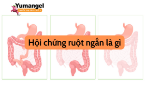 hội chứng ruột ngắn là gì