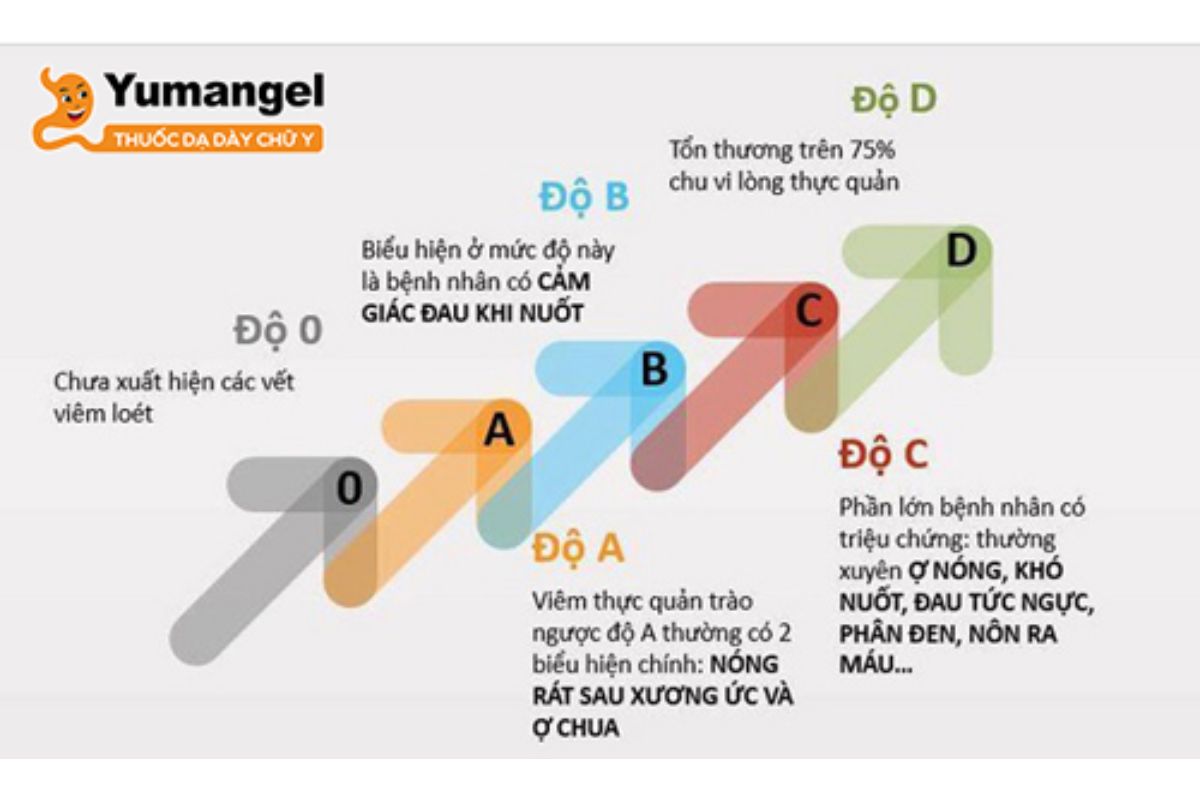trao-nguoc-da-day-thuc-quan-2