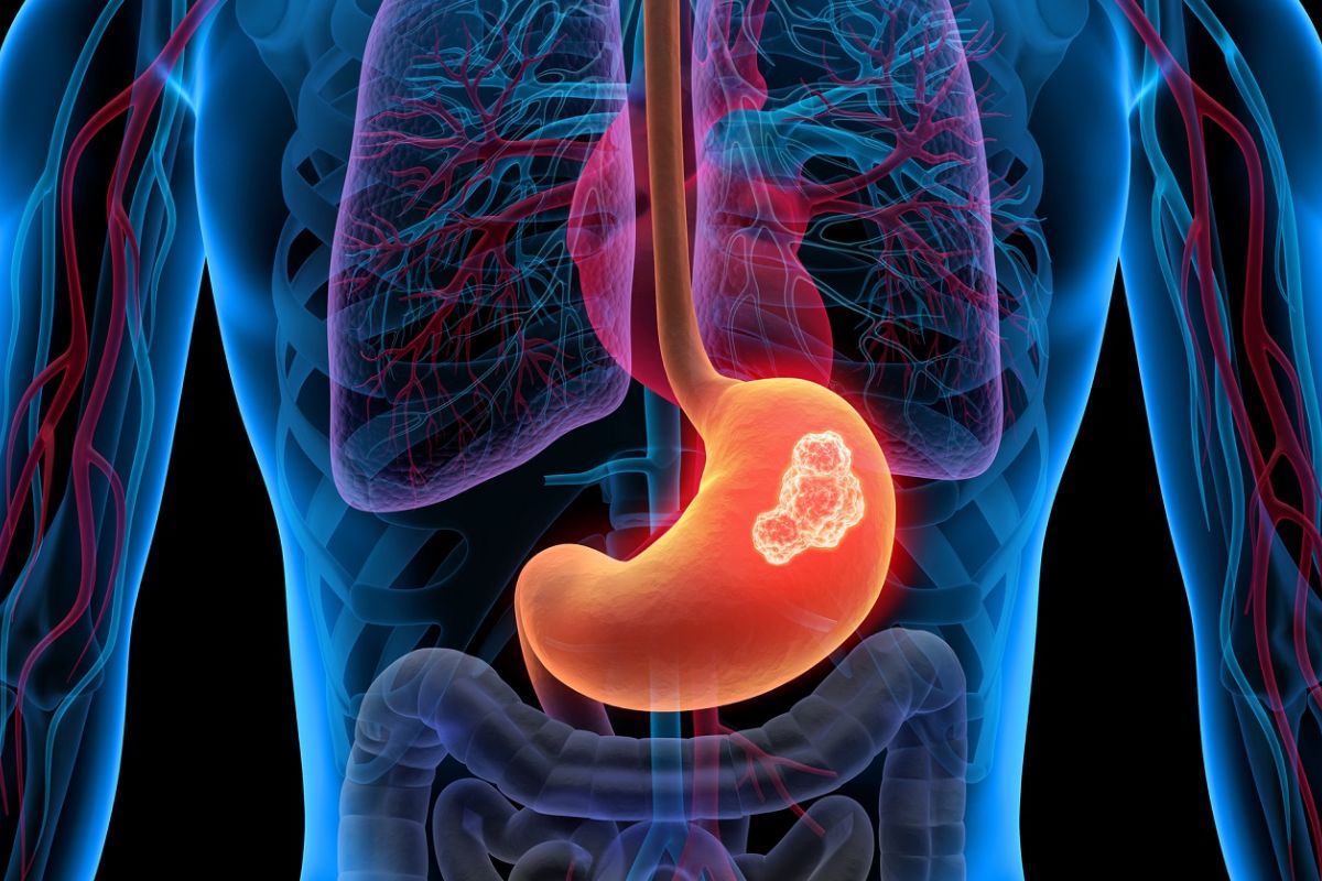 trao-nguoc-da-day-thuc-quan-5