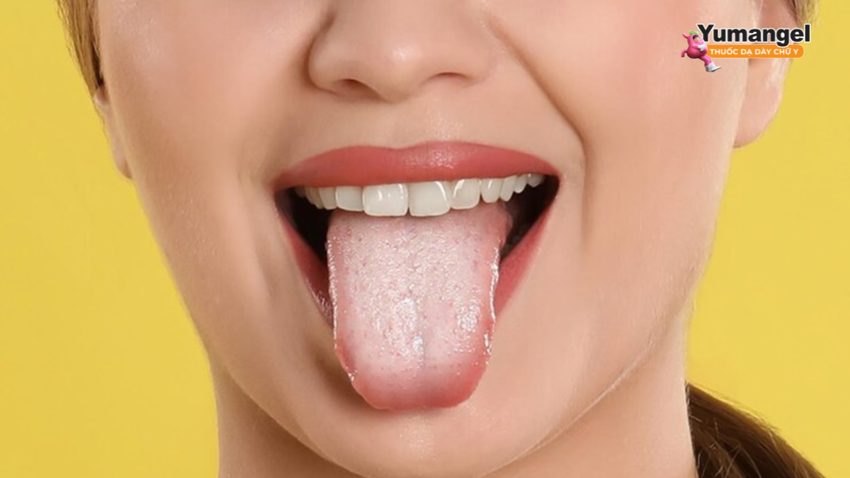 Sự phát triển của nấm candida làm tăng nguy cơ lưỡi trắng do trào ngược