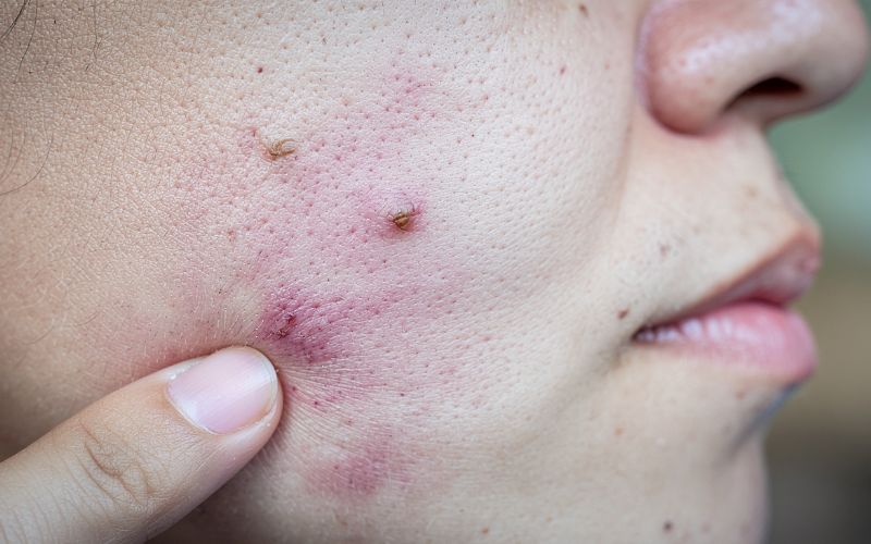 dau-da-day-an-banh-chung-duoc-khong-5