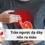 trào ngược dạ dày nôn ra máu