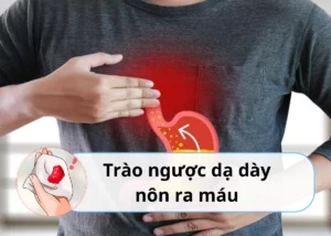 trào ngược dạ dày nôn ra máu