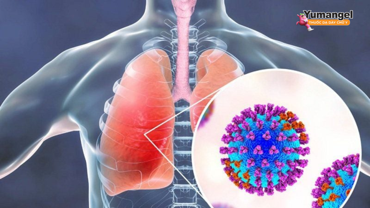 Nếu hít phải máu hoặc dịch nôn vào phổi có thể gây viêm phổi hít
