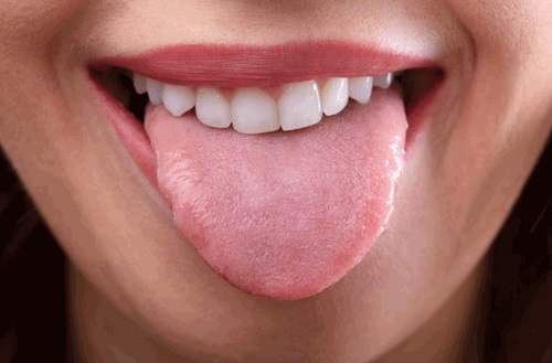 Lè lưỡi giúp ngắt cơn nấc cụt do bệnh trào ngược dạ dày