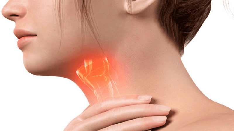 Hình ảnh viêm thanh quản do trào ngược im lặng gây ra