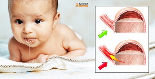 kích thước dạ dày trẻ sơ sinh
