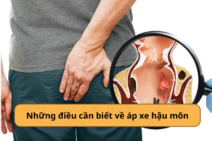 áp xe hậu môn