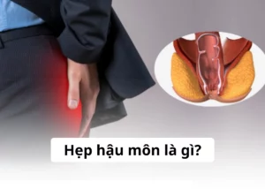 hẹp hậu môn