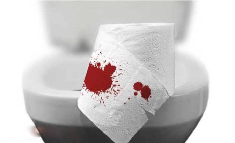 chảy máu hậu môn