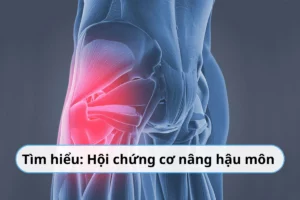 hội chứng cơ nâng hậu môn