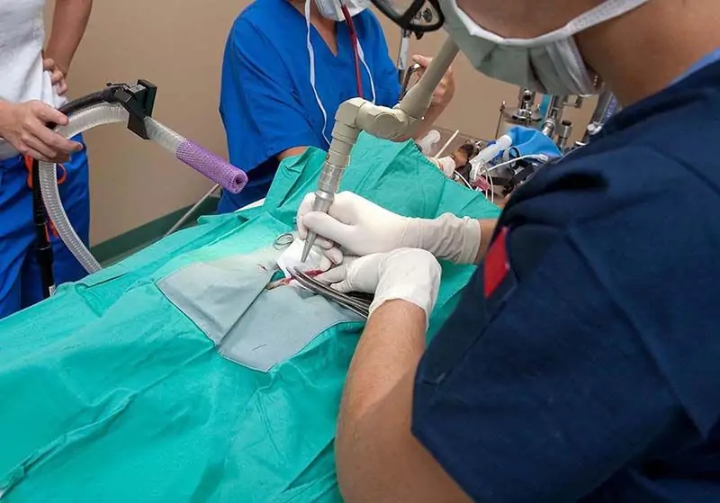 Các biến chứng sau mổ trĩ