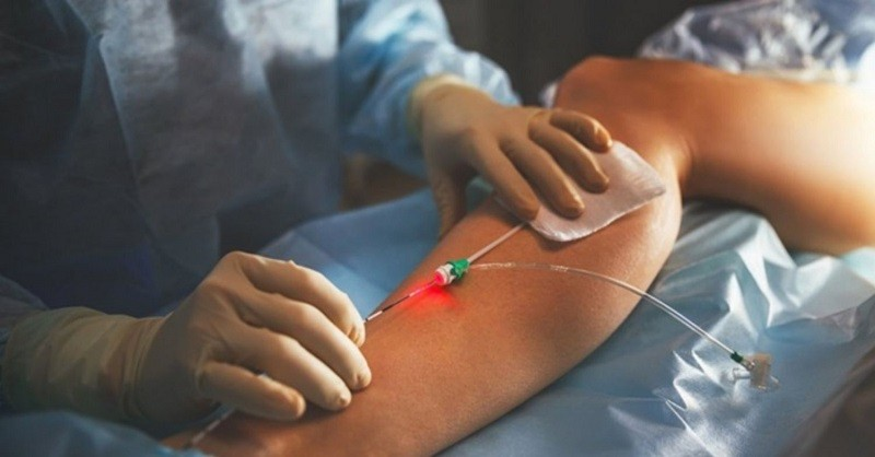 suy giãn tĩnh mạch hậu môn