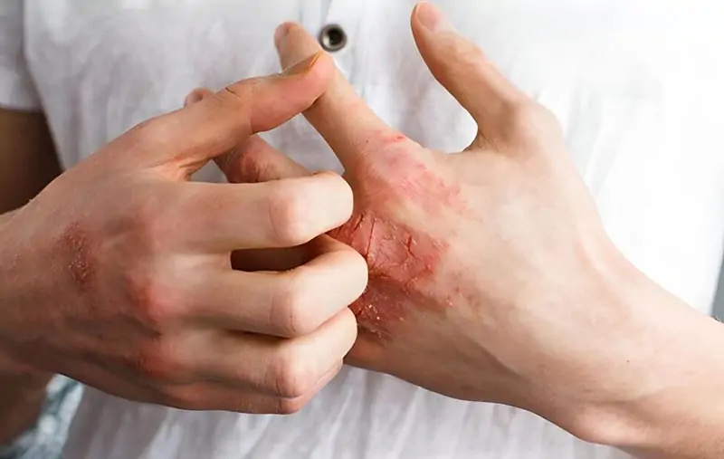 Câu hỏi thường gặp