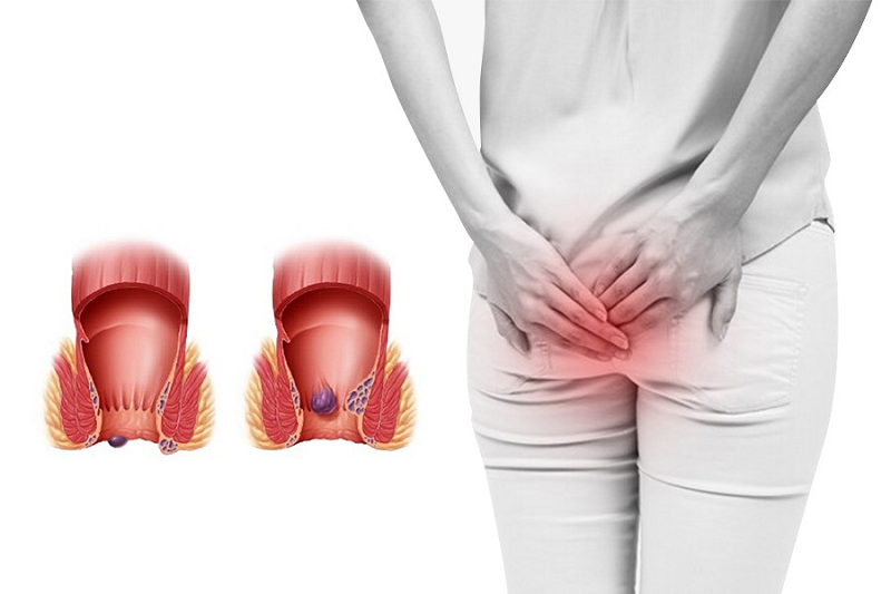 hậu môn ẩm ướt