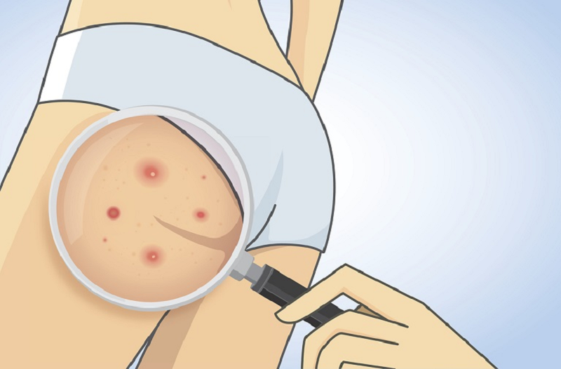 Kích ứng da và dị ứng
