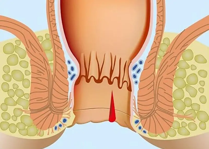 Thắc mắc thường gặp về phẫu thuật