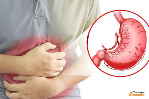 Tình trạng đau bụng sôi bụng đi ngoài kéo dài làm tăng nguy cơ biến chứng.