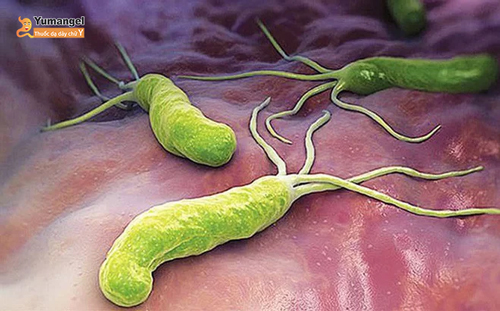 Hình ảnh vi khuẩn Hp/Helicobacter pylori.