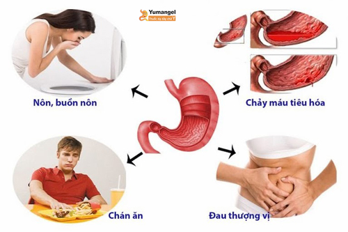 Các triệu chứng thường gặp của bệnh nhân viêm hang vị dạ dày.