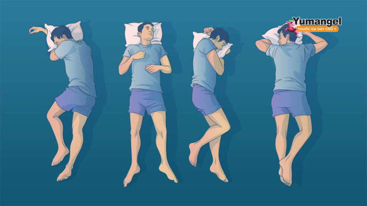 Trào ngược dạ dày nên nằm nghiêng bên nào tốt nhất?