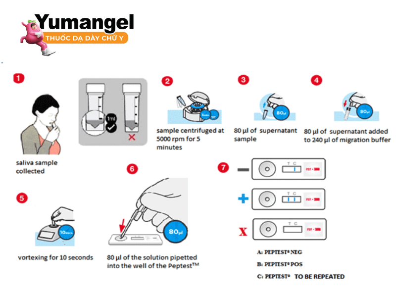 Kỹ thuật test nhanh phát hiện pepsin trong nước bọt (PepTest)