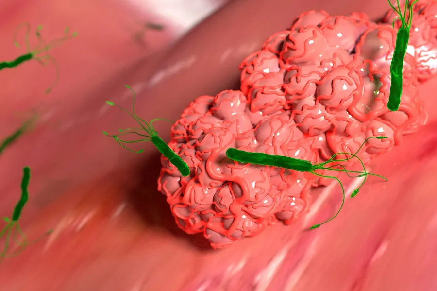 Mật ong có diệt H. pylori hoặc làm lành ổ loét không?