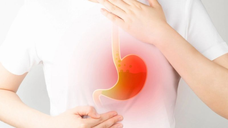 Viêm trào ngược dạ dày thực quản độ A