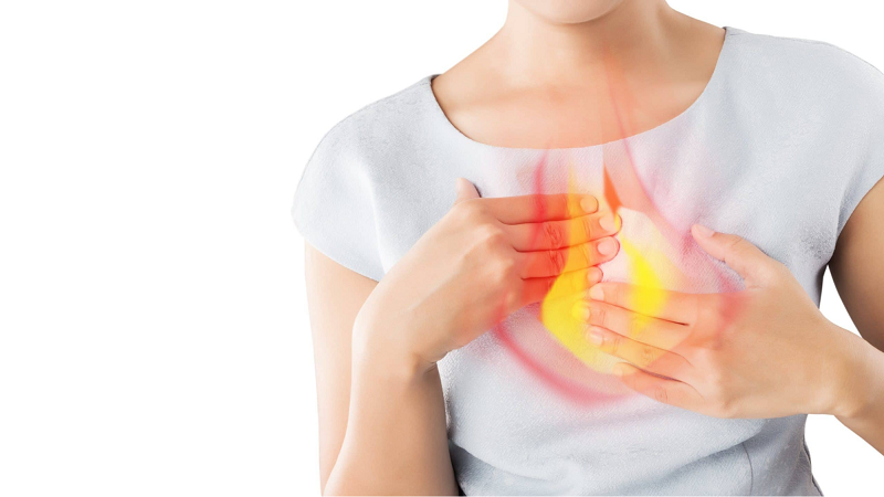 Viêm trào ngược dạ dày thực quản độ A