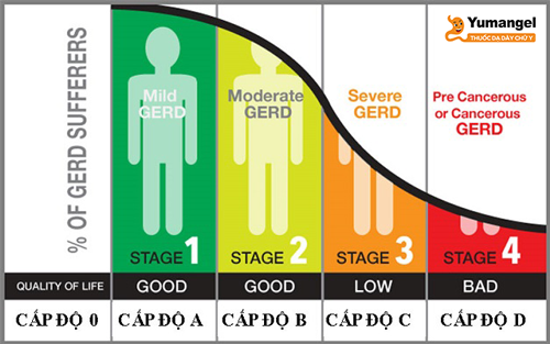 Hình ảnh mô tả 5 cấp độ của bệnh trào ngược dạ dày thực quản