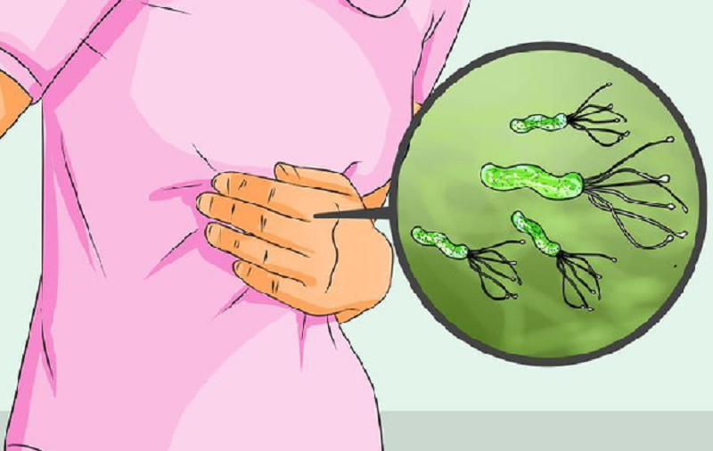 các bệnh về dạ dày