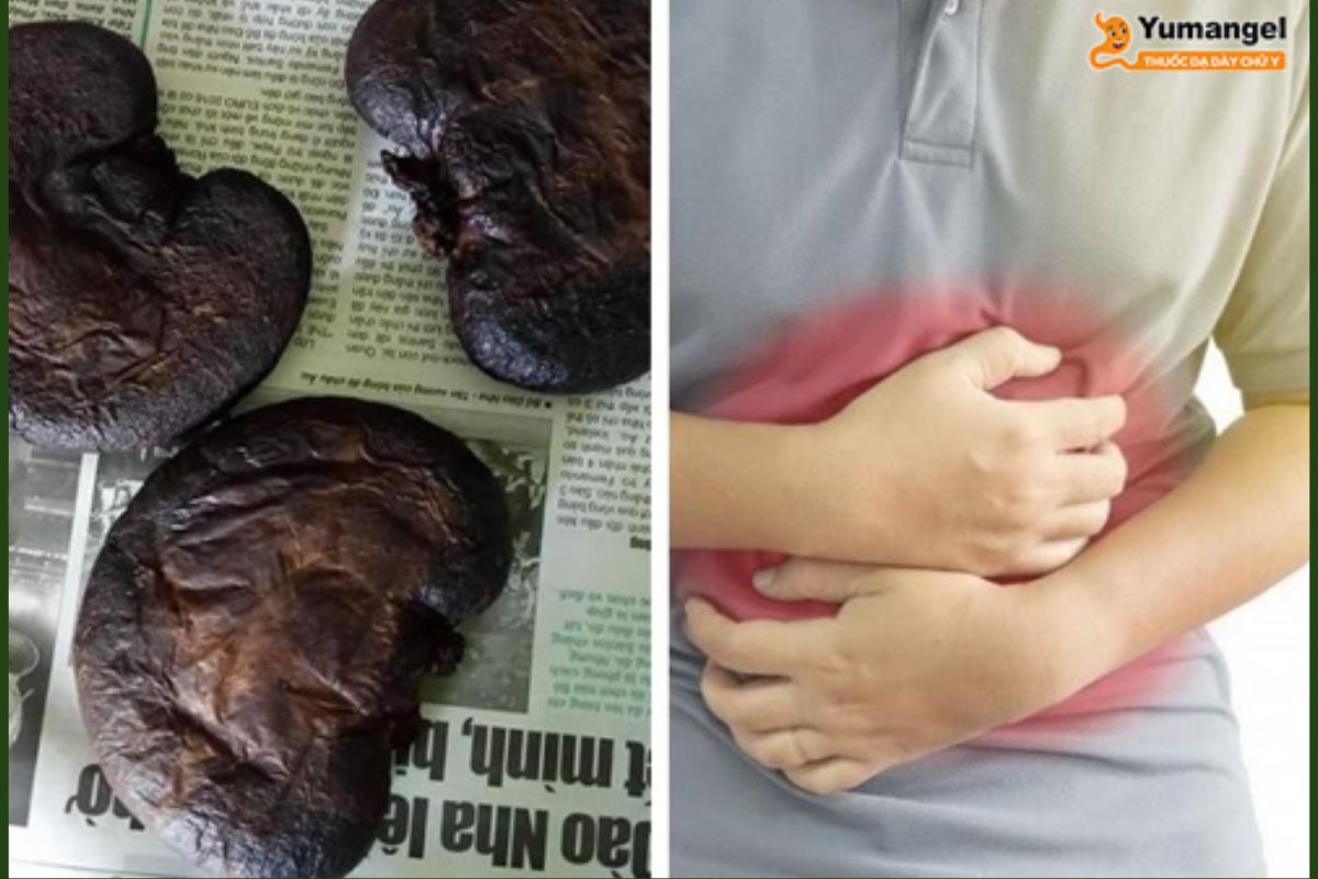 da-day-nhim-chua-benh-da-day-2