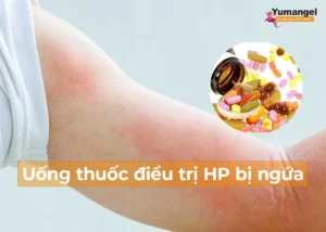 uống thuốc điều trị HP bị ngứa