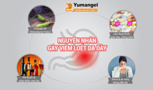 Nguyên nhân gây viêm loét dạ dày tá tràng