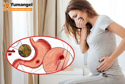 Mẹ bầu bị viêm loét dạ dày thường xuyên bị đau thượng vị kèm buồn nôn, nôn mửa.