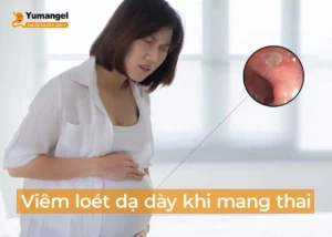 viêm loét dạ dày khi mang thai