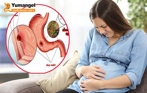 Không chỉ gây ảnh hưởng tới sức khỏe của mẹ, viêm loét dạ dày khi mang thai kéo dài còn là tăng nguy cơ sinh non, trẻ sinh ra nhẹ cân và sức khỏe kém.
