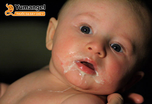 Trẻ sơ sinh thường xuyên bị buồn nôn và nôn trớ cũng là dấu hiệu trẻ sơ sinh bị đau bụng