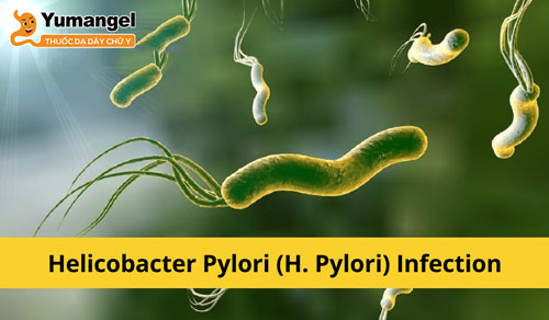 Ngăn ngừa nhiễm H.pylori là biện pháp phòng ngừa viêm loét dạ dày tá tràng hiệu quả.