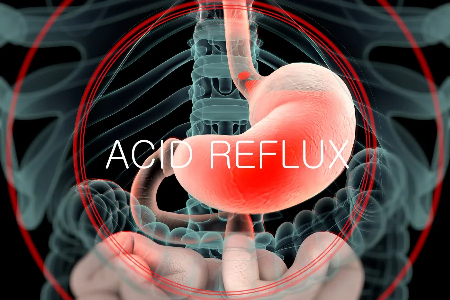 Lạc tiên có làm dạ dày tiết nhiều acid hơn không?