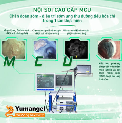 Công nghệ nội soi cao cấp MCU là sự kết hợp của phương pháp nội soi phóng đại nhuộm màu (MCE) và siêu âm nội soi (EUS).