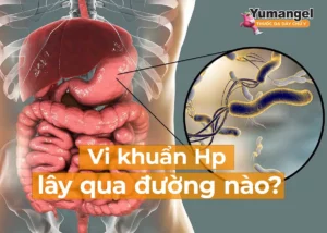 Vi khuẩn HP lây qua đường nào